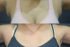resize