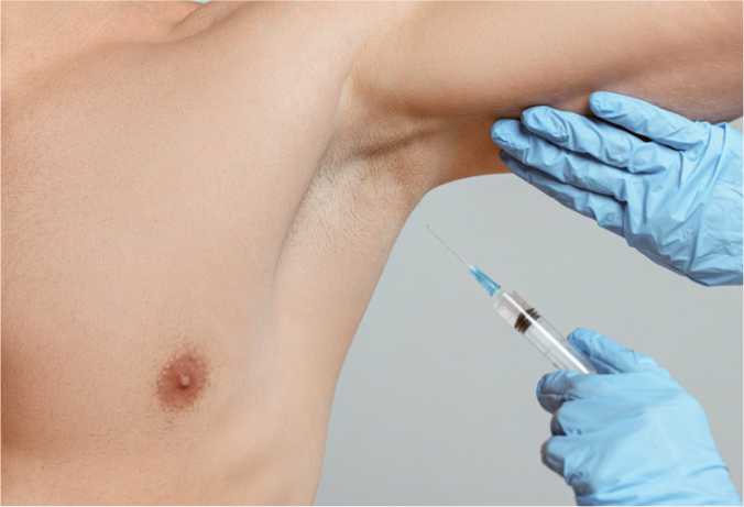 Benefits of Excessive Sweating Treatment