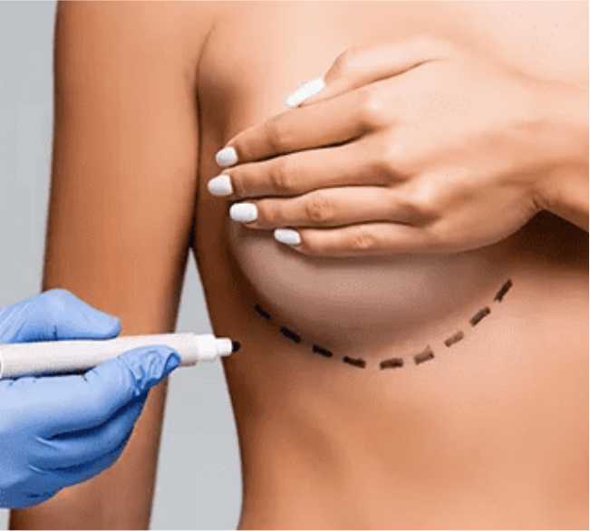 Ideal Candidates for Breast Augmentation