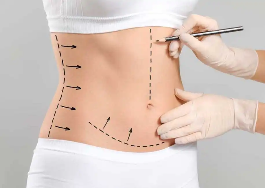 Benefits of Body Surgery