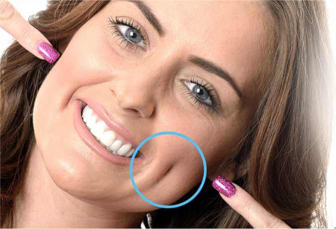 Benefits Of Dimple Creation Surgery