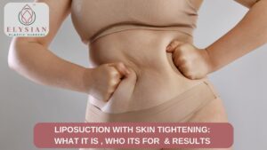 best plastic surgeons in Surat