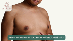 best plastic surgery centres in Surat,