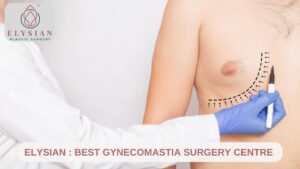 Best Gynecomastia Surgery Centre In Surat