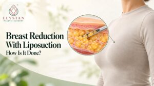 Breast Reduction Surgery