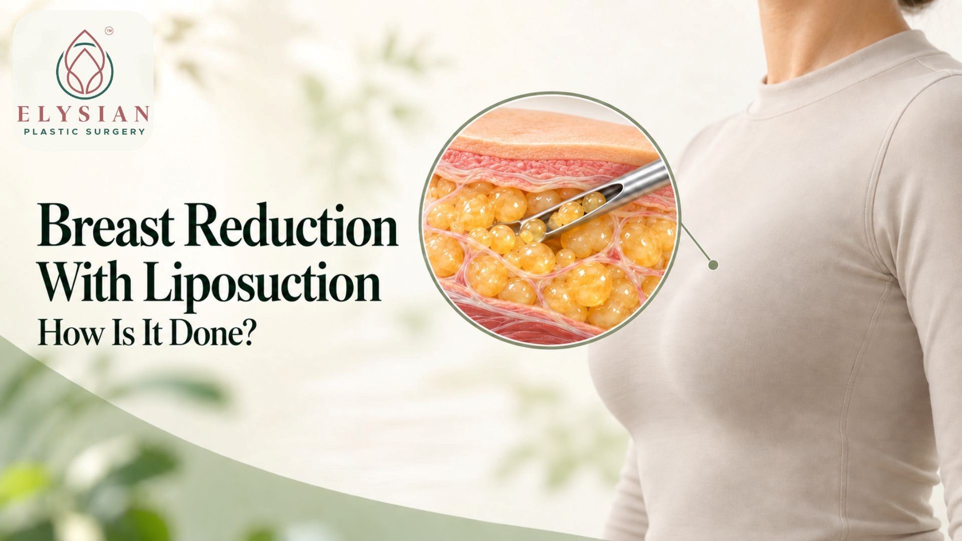 Breast Reduction Surgery